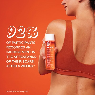Bio-Oil Skincare Body Oil and Scar Treatment with Vitamin E 4.2 fl oz - Imperfect Box